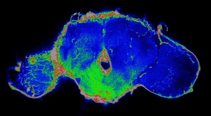 The fruitfly research can possibly improve survival rates in cancer patients. 1 fruitfly1